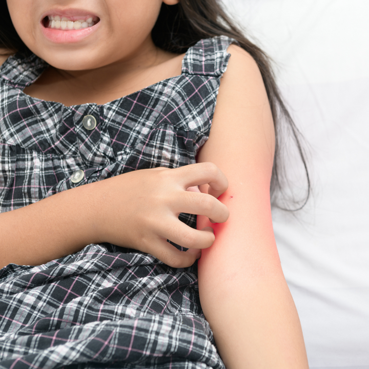 Dermatite atopica – conoscerla per affrontarla